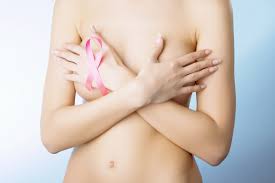 breast cancer2